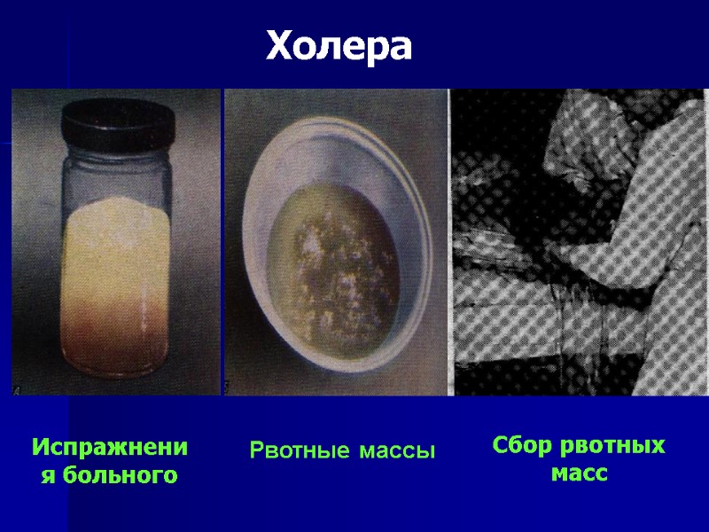 Испражнения больного  Рвотные массы Сбор рвотных масс Холера